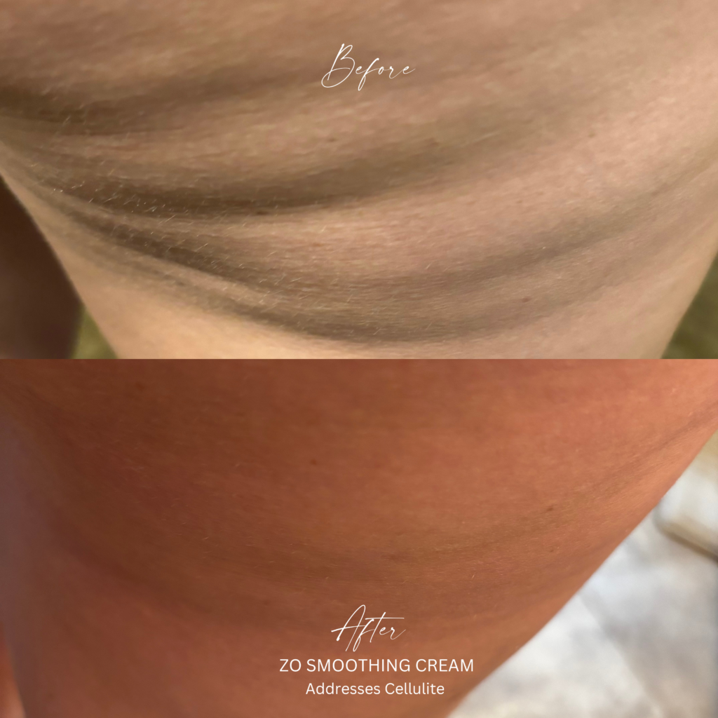 Skin Treatment Before and After