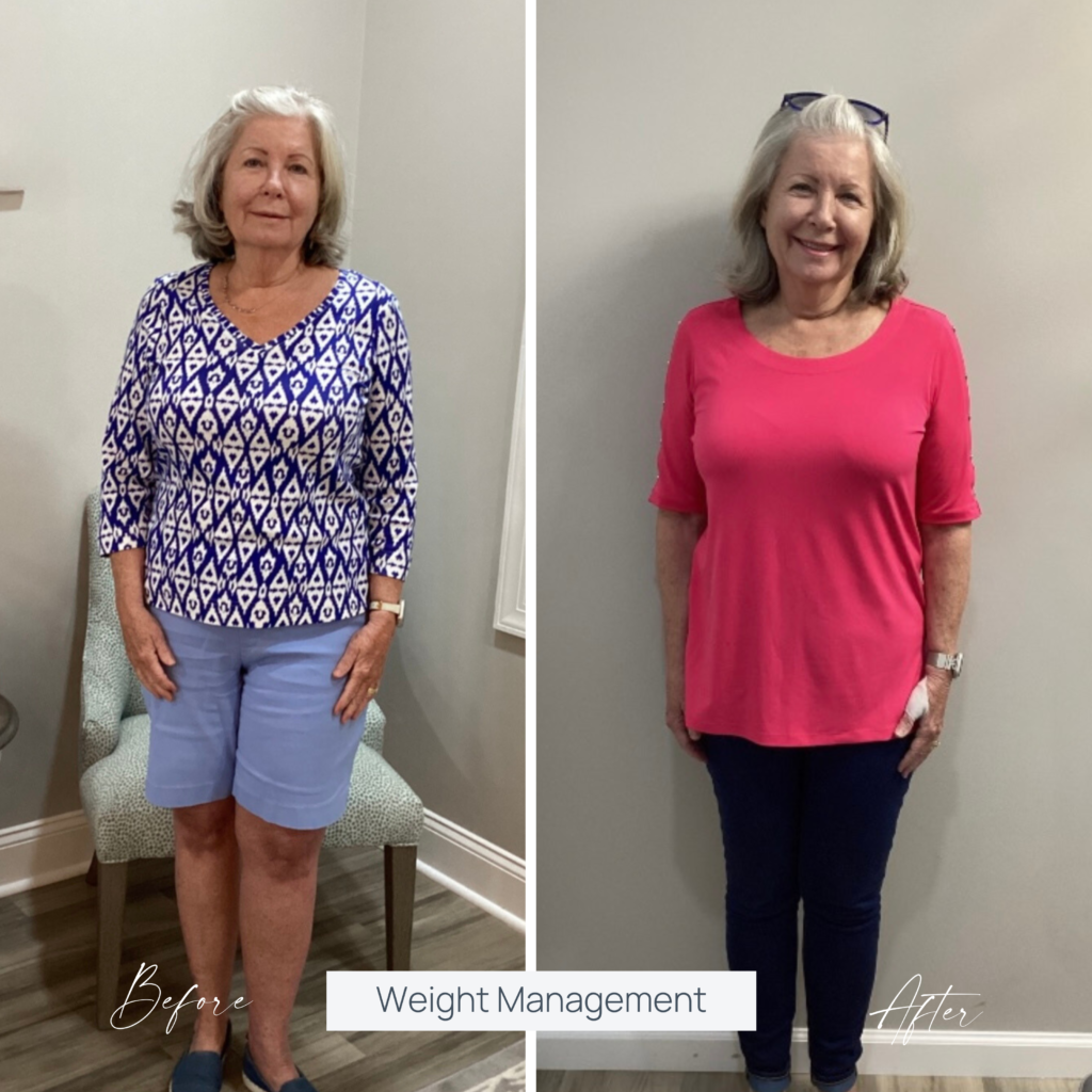 Weight Loss Treatment Before and After
