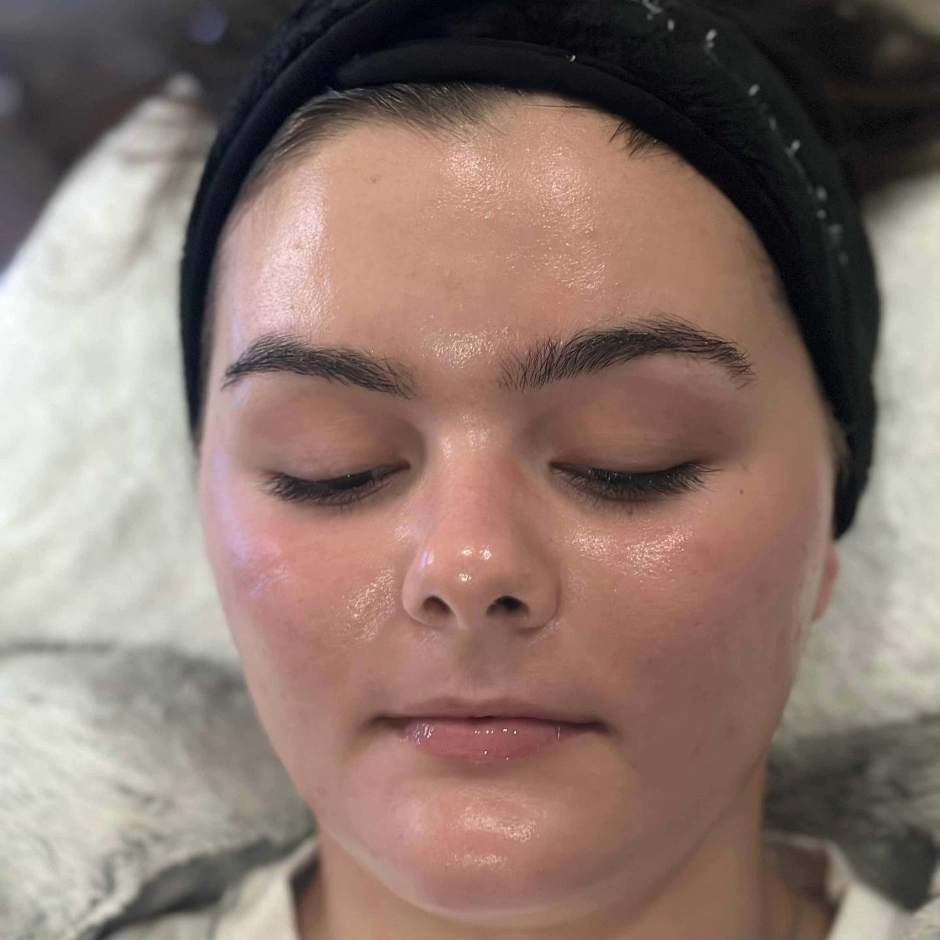 Facials and chemical Peels