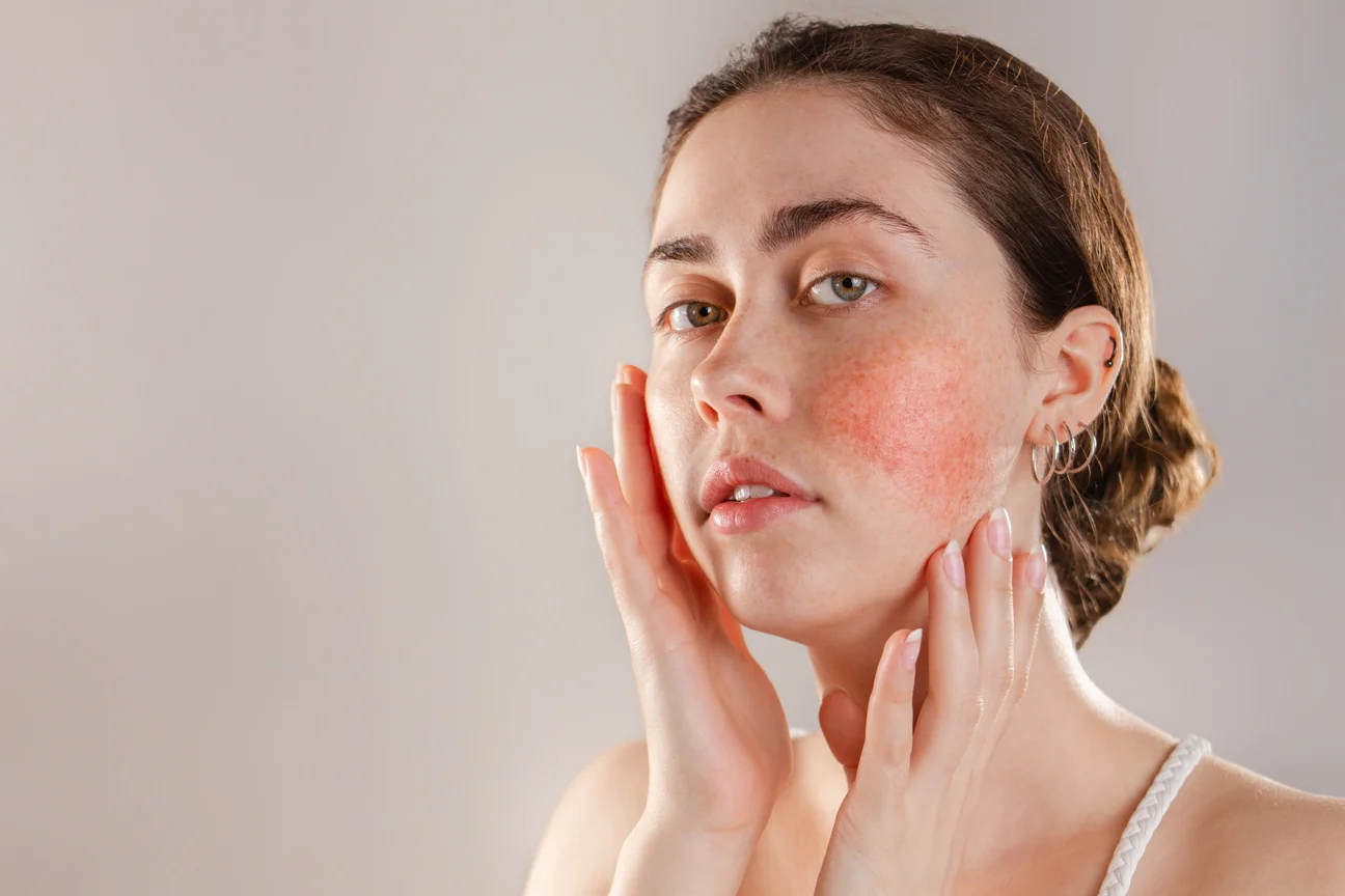 Sensitive Skin and Rosacea Facial in Goldsboro NC