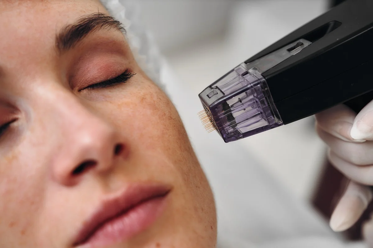 Professional Microneedling in Goldsboro NC
