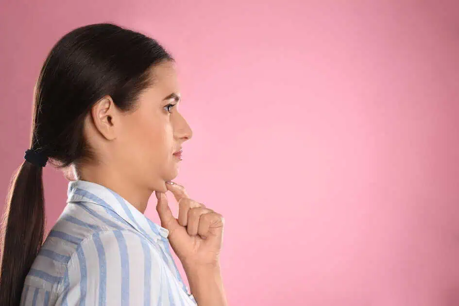 Woman with submental fat beneath the chin before double chin reduction treatment